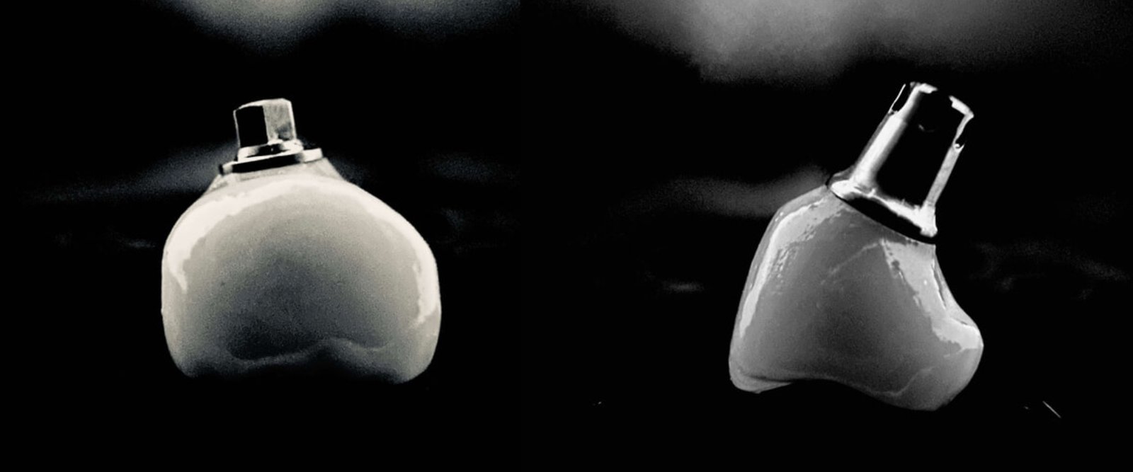 Palm-Bleach-Pic4